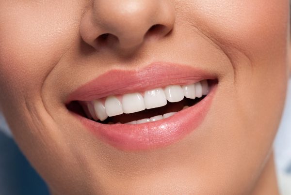Gum Recession Causes - Dr. Mistry Dentistry