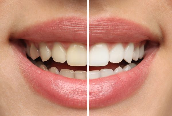 Cosmetic Dentistry Solutions