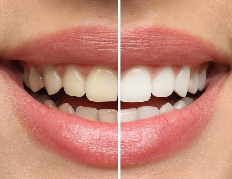 Cosmetic Dentistry Solutions