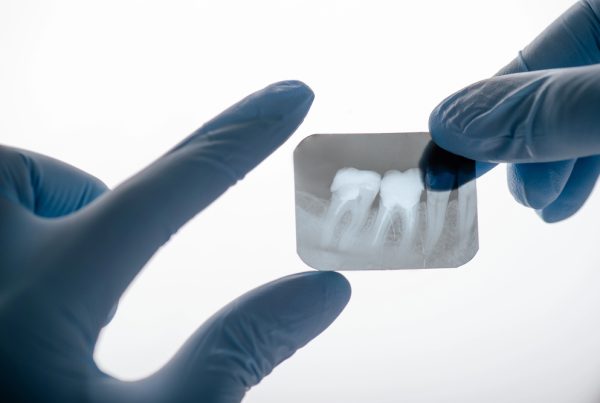 dental x-rays