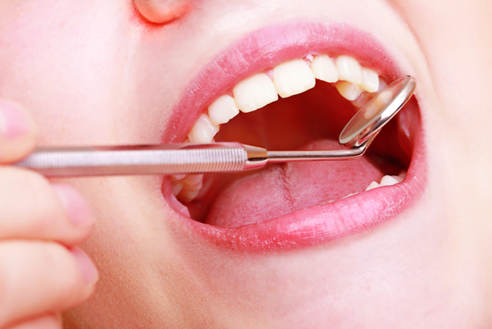 Understanding Dental Crowns and Bridges: Anterior Crowns