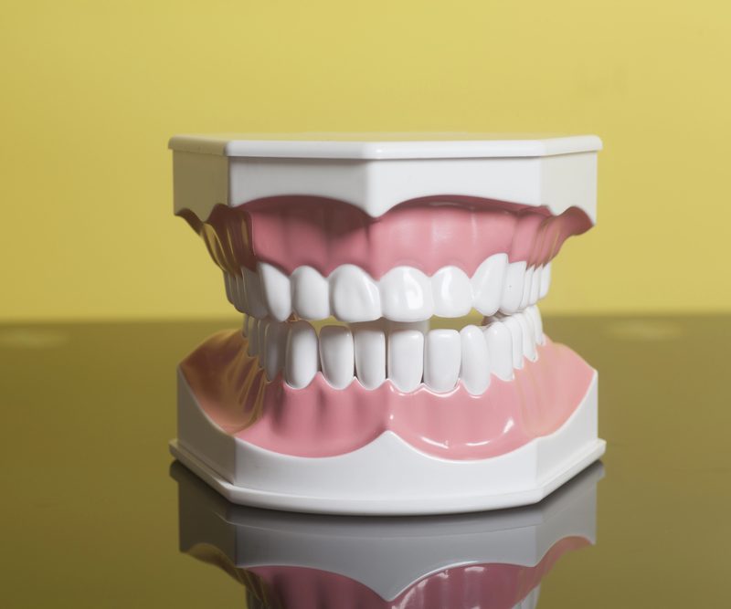 Gum Surgery In Guelph