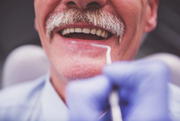 dentures guelph dr. mistry dentistry