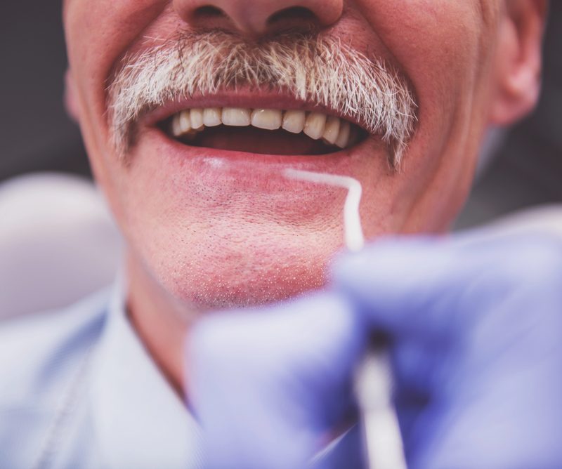 dentures guelph dr. mistry dentistry