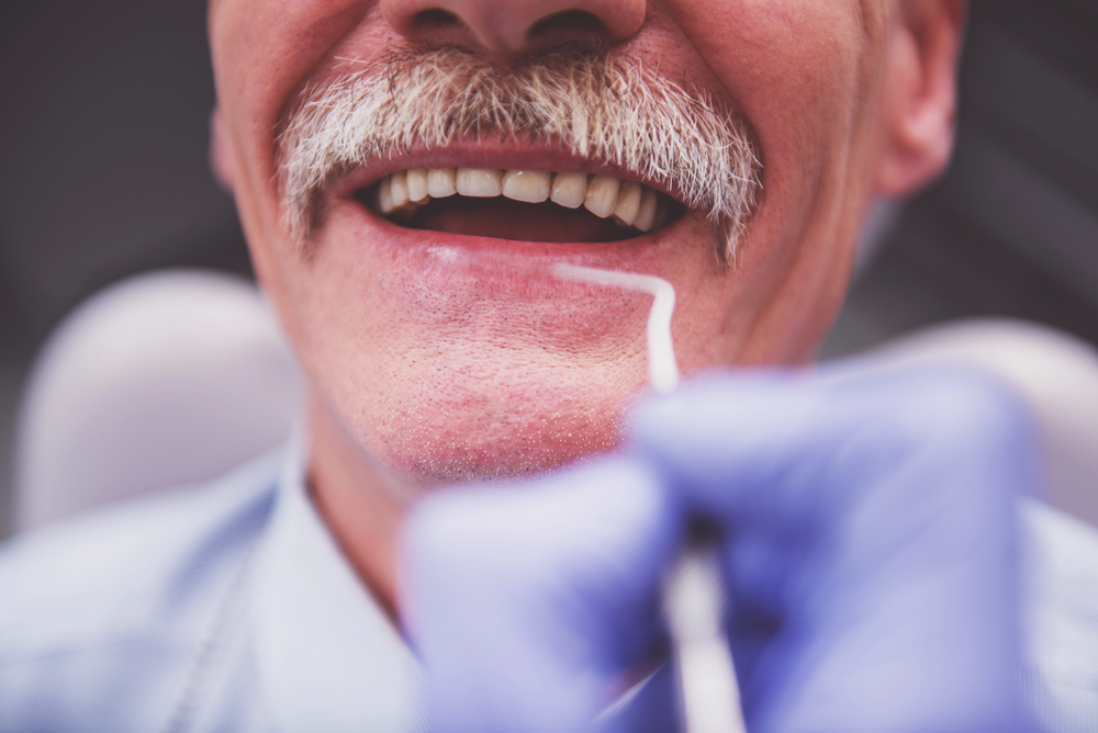 How to Get A Perfect Fit For Your Dentures in Guelph with Dental Implants
