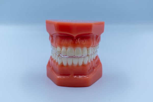 Guelph Dentures
