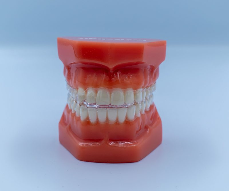 Guelph Dentures