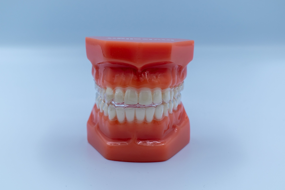 Important Things You Should Know Before Getting Dentures