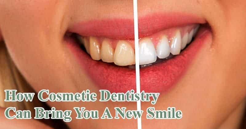 Cosmetic Dentistry Solutions