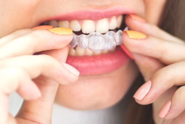 Orthodontic Treatment Dr. Mistry Dentistry