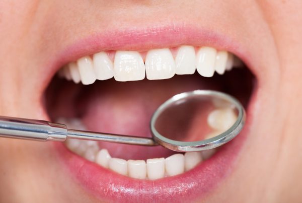 Tooth Fillings in Guelph Ontario Dr. Msitry Dentistry