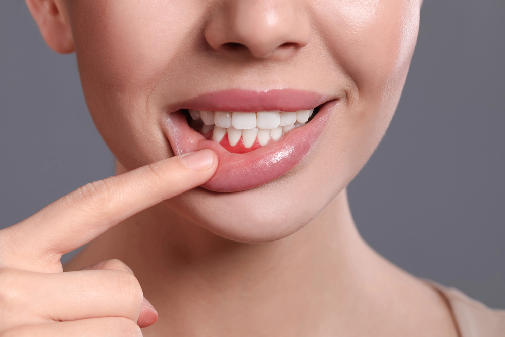 Periodontal Disease Treatment in Guelph
