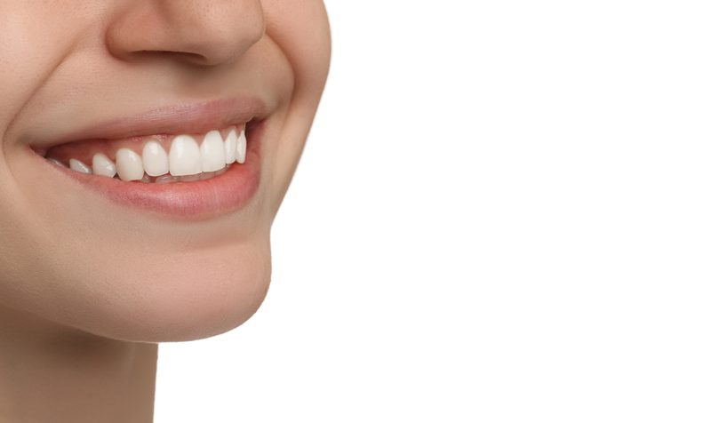porcelain-veneers-doctor-mistry-dentistry