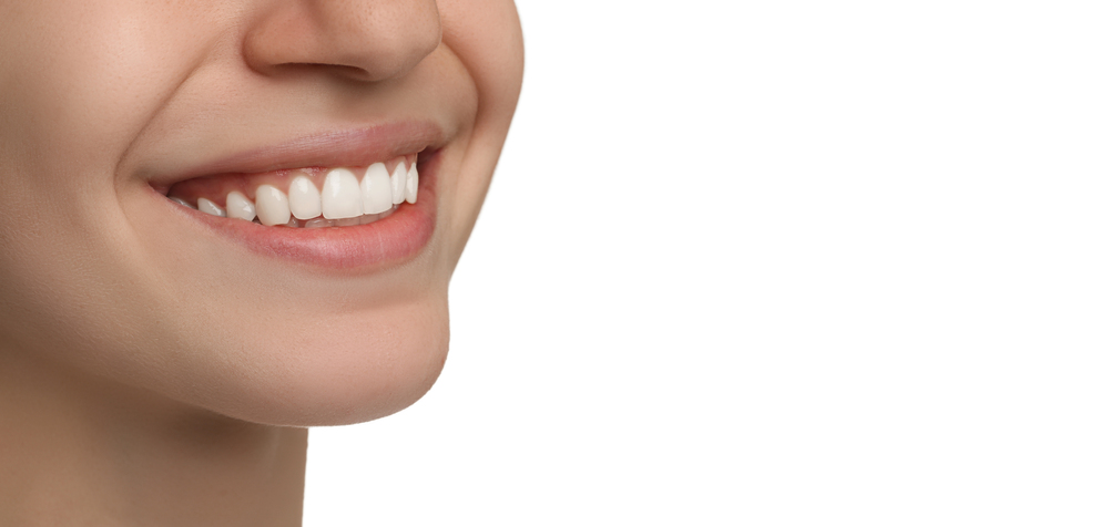 Porcelain Veneers in Guelph