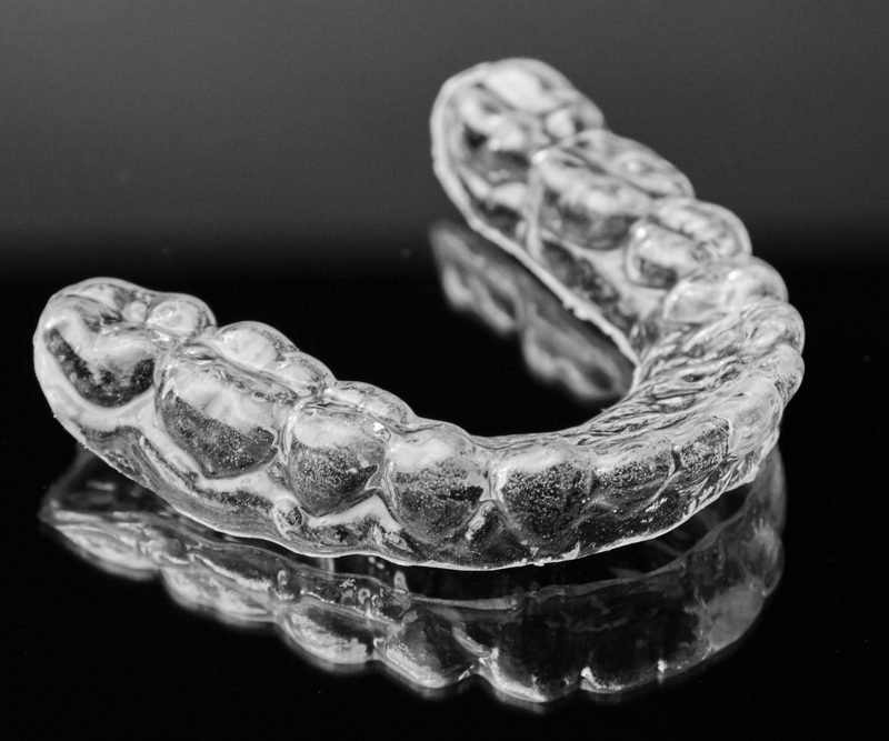 Invisalign aligner guelph dentist