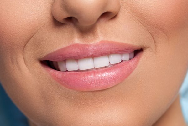Close-up of a woman's smile