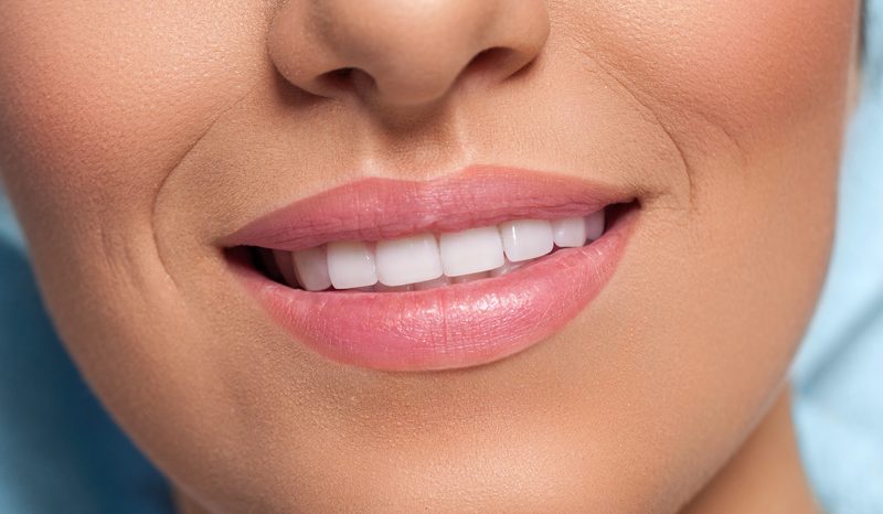 Close-up of a woman's smile